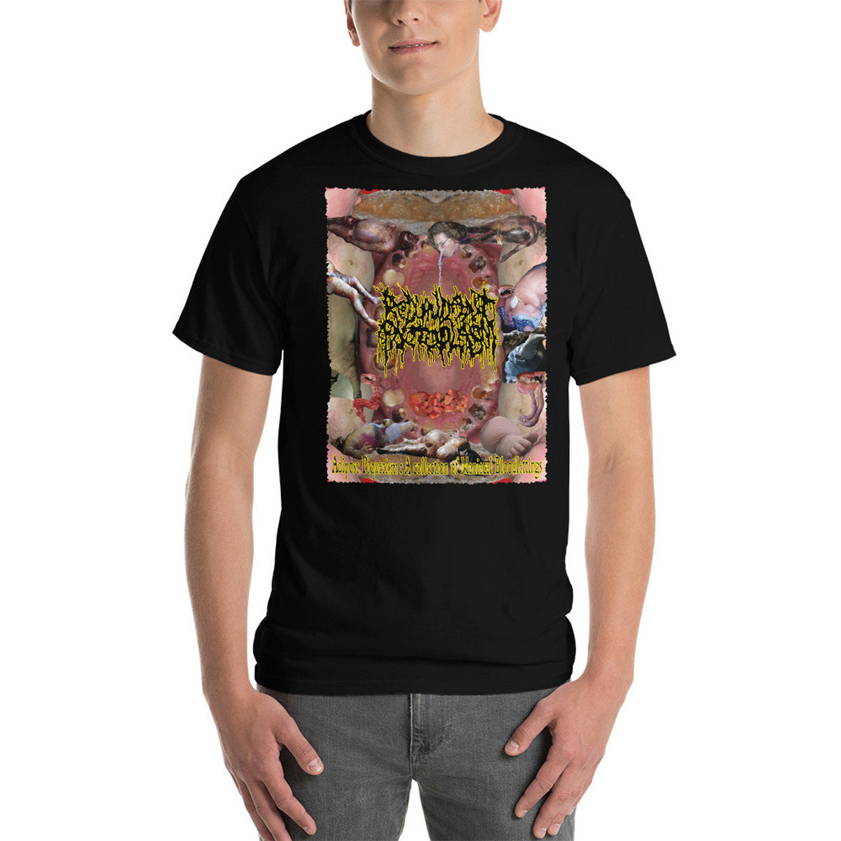 REDUNDANT PROTOPLASM - Adipose Piquerism: A Collection Of Maniacal Bloodlettings T-Shirt