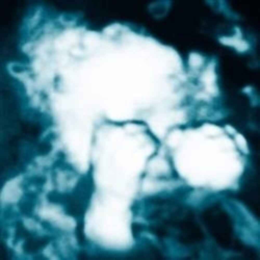 Nino Reptil Angel (Spa) [LP]