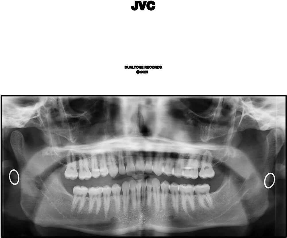 Jvc [LP]