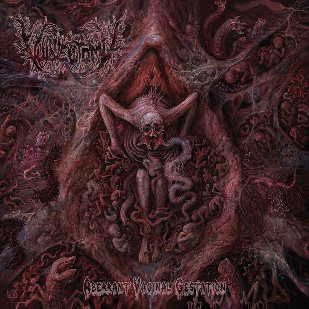 Aberrant Vaginal Gestation [CD]