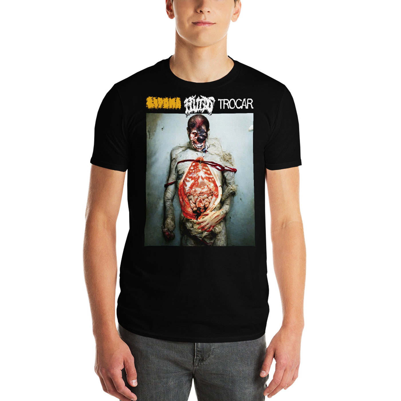 LIPOMA / FLUIDS / TROCAR - Dissertations Full Color T-Shirt